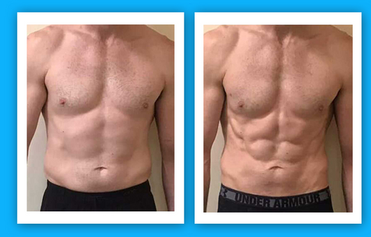 EMS + RF - Body Contouring - 8 Session Package