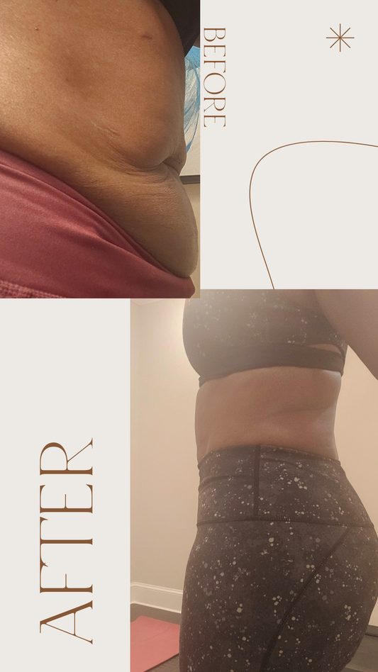 Cryo + EMS Body Contouring Session - 4 Sessions