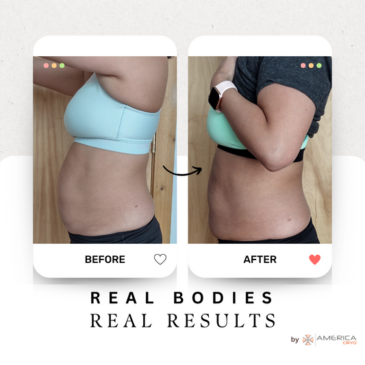 Cryo + EMS Body Contouring Session - 10 Sessions